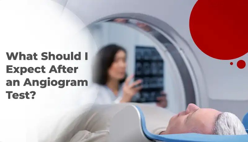 What Should I Expect After an Angiogram Test?