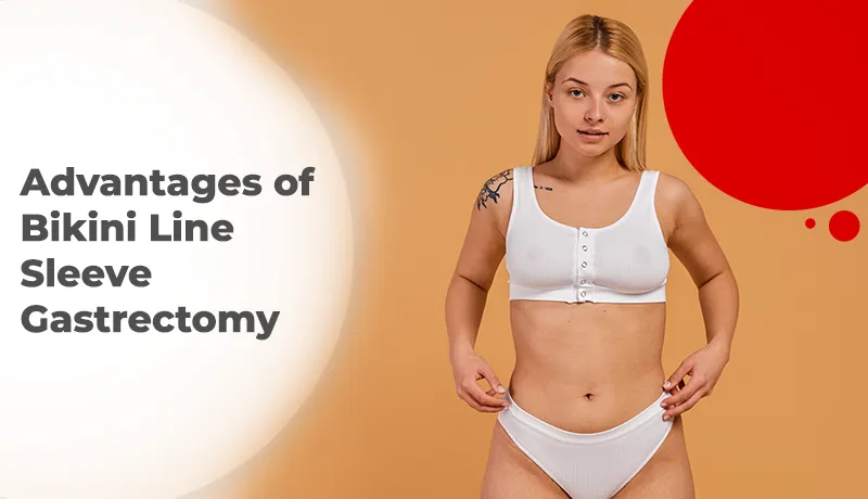 Advantages of Bikini Line Sleeve Gastrectomy