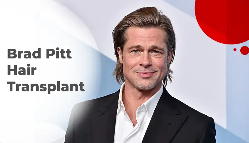 Brad Pitt Hair Transplant