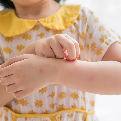 Pediatric Dermatology: Caring for Your Child's Skin Health