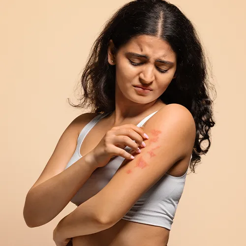 Eczema Uncovered: Identifying Symptoms and Finding Relief