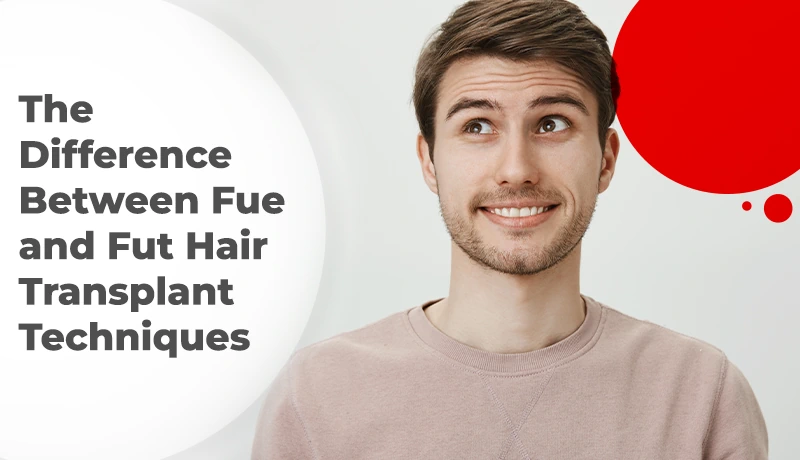 The Difference Between FUE and FUT Hair Transplant Techniques