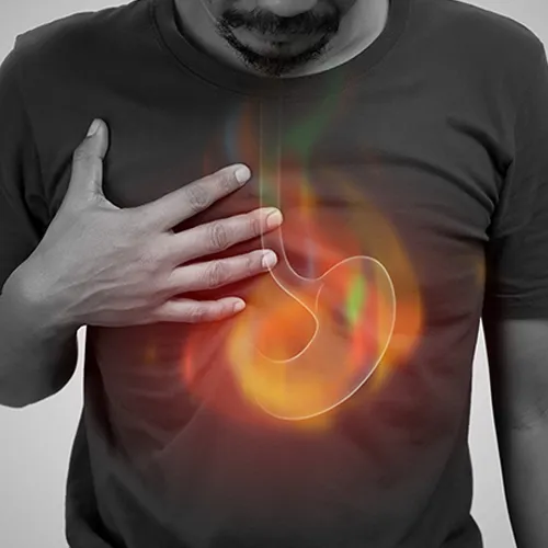 How to Get Rid of Acid Reflux: Best Proven Home Remedies