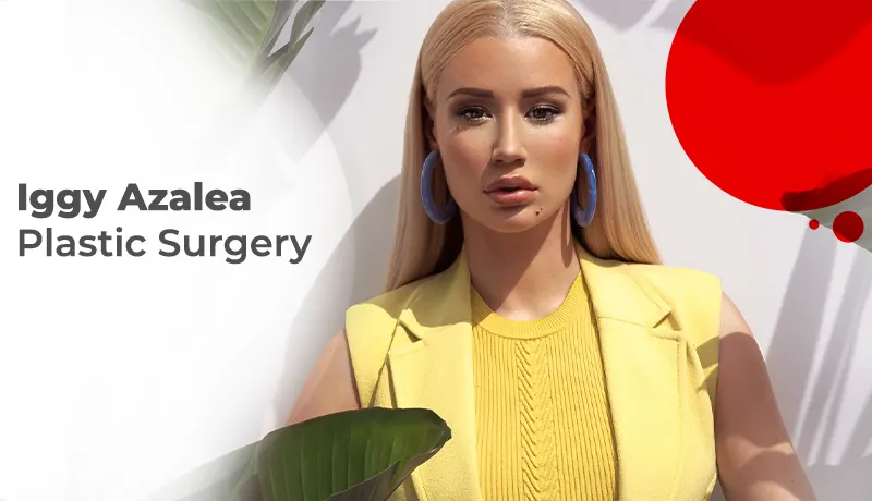 Iggy Azalea Plastic Surgery