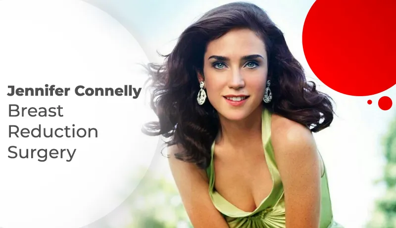 Jennifer Connelly Breast Reduction Surgery