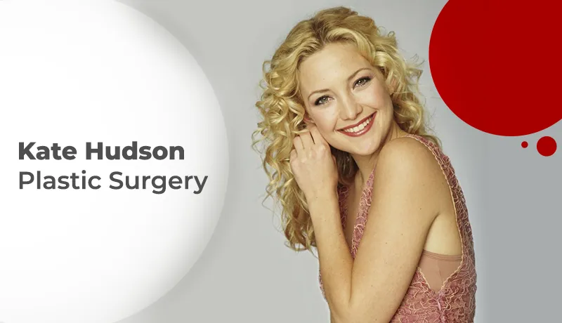 Kate Hudson Plastic Surgery