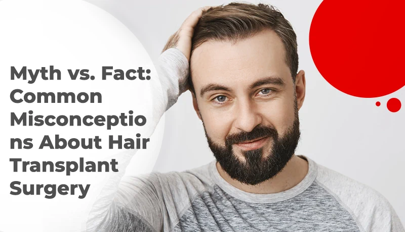 Myth vs. Fact: Common Misconceptions About Hair Transplant Surgery