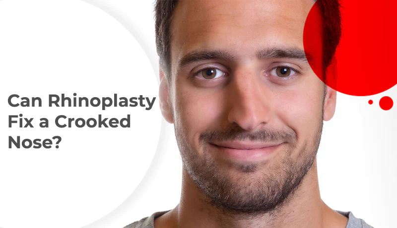 can rhinoplasty fix a crooked nose cover