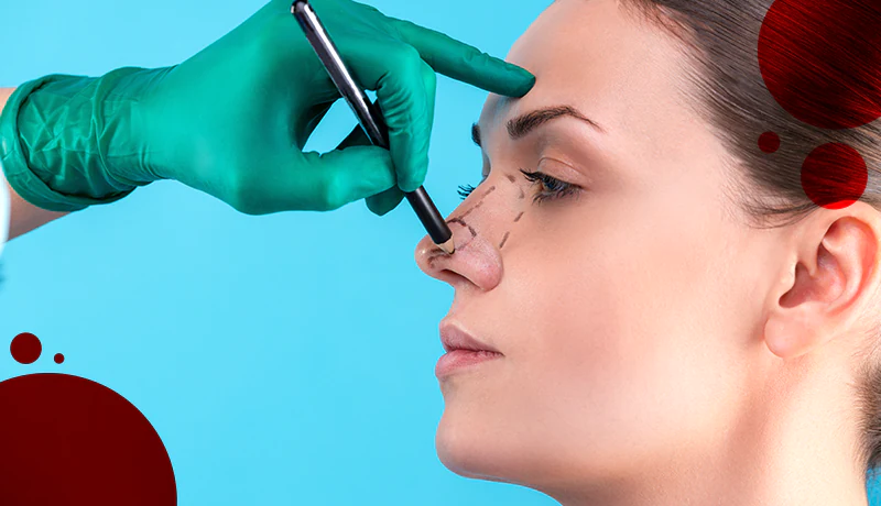 examination for nose job surgery